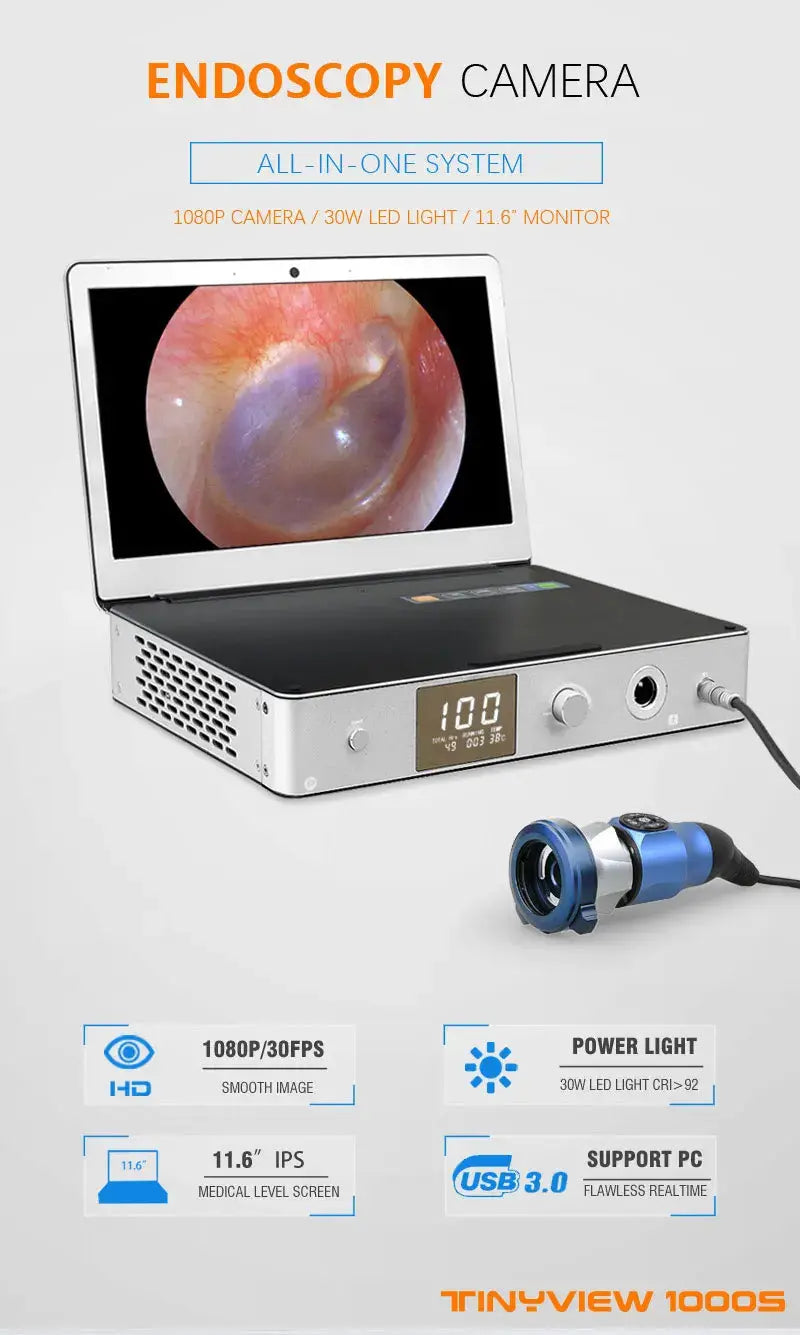 Medeasy Full HD: Endoscopio Médico de Precisión. Vanguardia y Elegancia para Expertos.