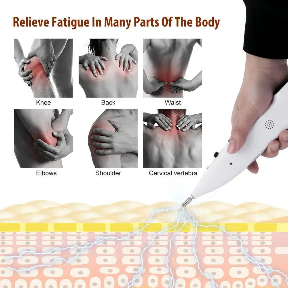 Pluma de Acupuntura Élite: Bienestar & Alivio Sofisticado para Profesionales.