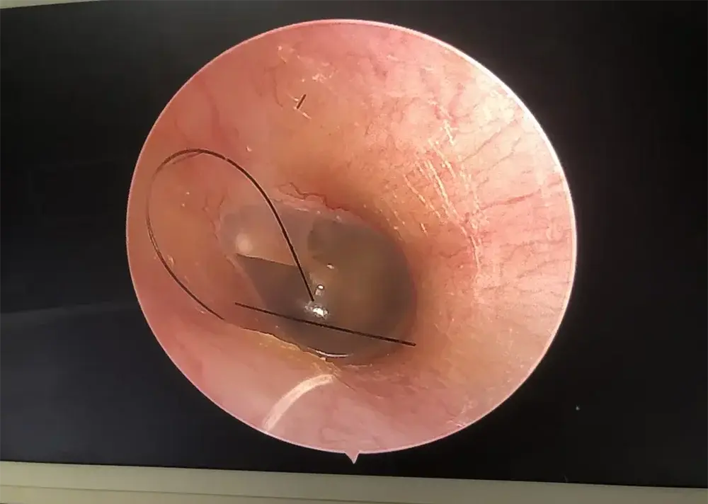 Medeasy ME-040: Endoscopio Clínico Full HD. Precisión Experta, Estilo Refinado.