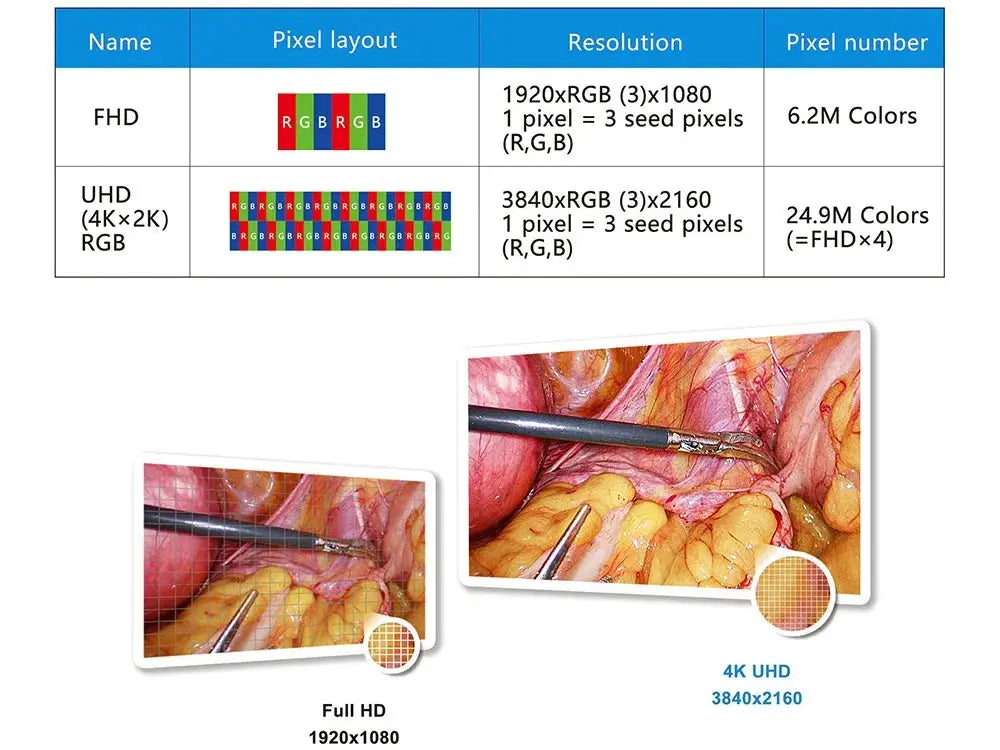 Visión Élite 4K UHD: Sistema Endoscópico para Precisión Quirúrgica y Confort Superior.