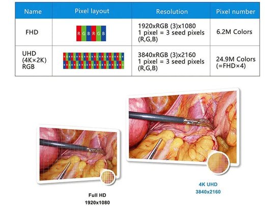 Visión Élite 4K UHD: Sistema Endoscópico para Precisión Quirúrgica y Confort Superior.