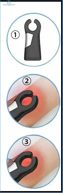 Alextrasza: Detector Venoso Profesional de Precisión InfrarrojaAlextrasza Detector Venoso Profesional con Tecnología Infrarroja: Visión Confiable y Diseño Premium.